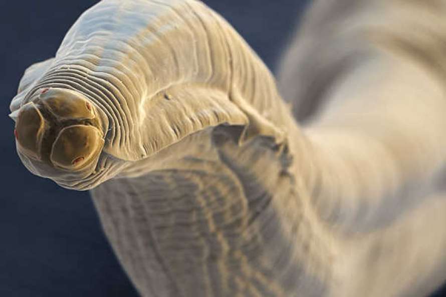Брр! В каждом пятом жителе Земли живут черви-паразиты - ученые 1