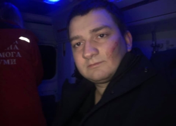 В Сумах жестоко избили депутата от “Слуги народа”