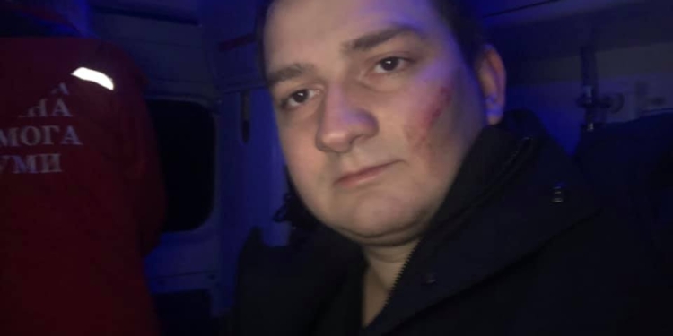 В Сумах жестоко избили депутата от “Слуги народа”