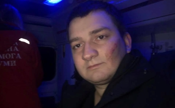 Дело Бабченко живет. Нападение на “слугу народа” в Сумах инсценировала СБУ