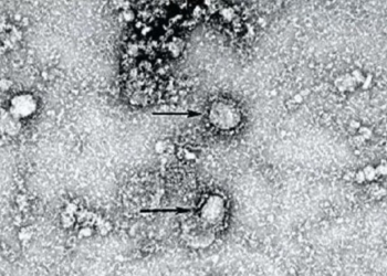 Появилось фото “китайского” коронавируса