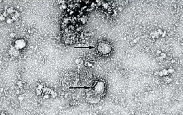 Появилось фото "китайского" коронавируса 1
