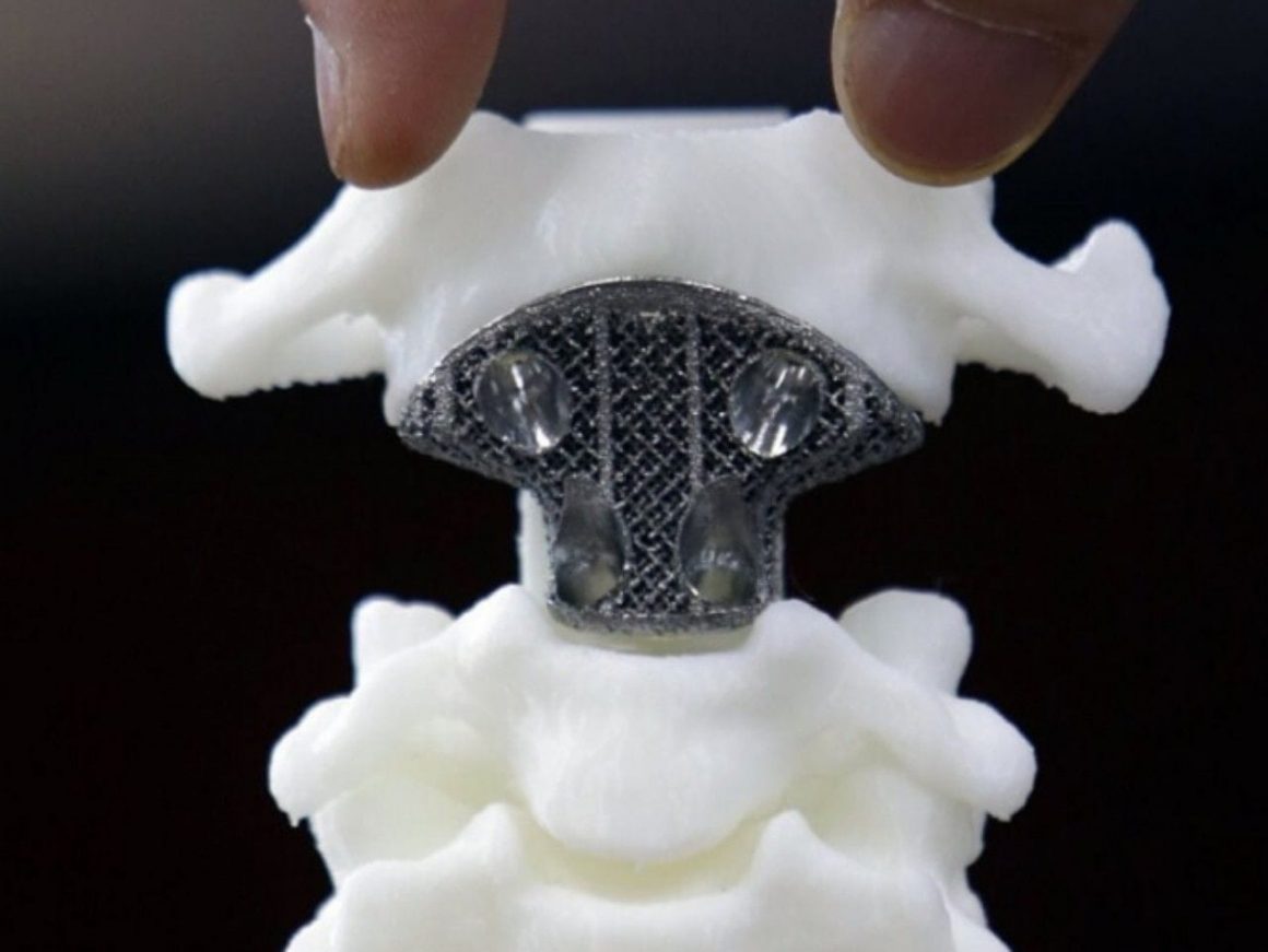 Он будет печатать органы на 3D-принтере.