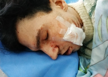 В Николаеве 19-летний парень изрезал знакомого, у которого напросился пожить (ФОТО)