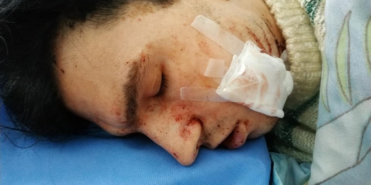 В Николаеве 19-летний парень изрезал знакомого, у которого напросился пожить (ФОТО)