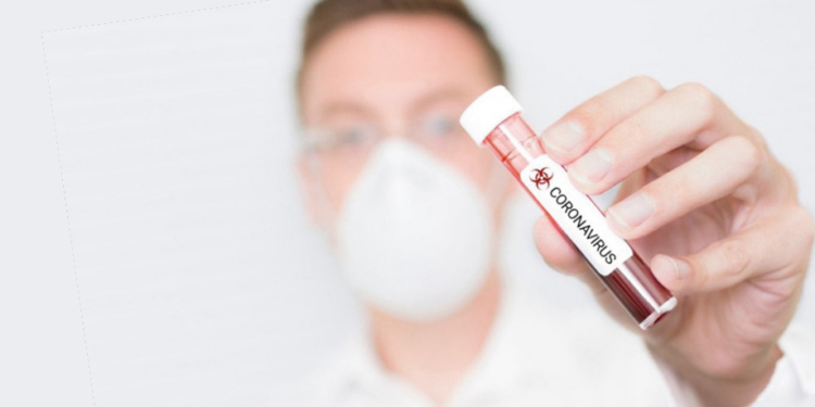Без паники! Что делать, если вы заподозрили у себя коронавирус? Инструкция