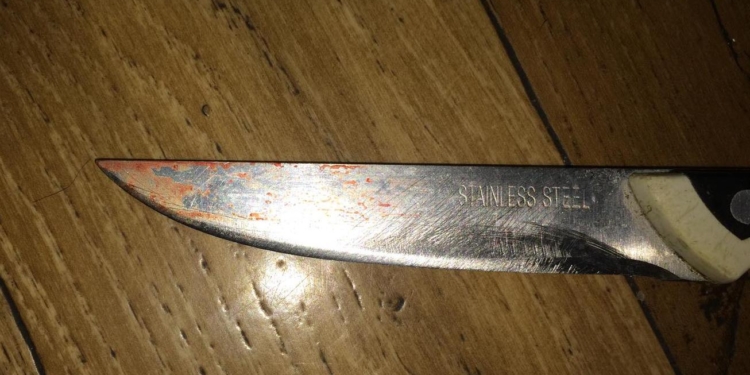 На Николаевщине ссора двух пациентов больницы закончилась поножовщиной