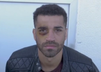 Британский боксер поставил сам себе фингал, записывая видеоурок (ВИДЕО)