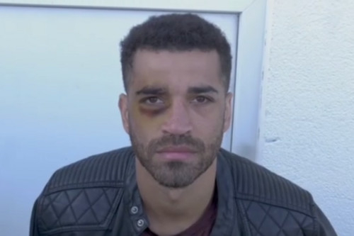 Британский боксер поставил сам себе фингал, записывая видеоурок (ВИДЕО)