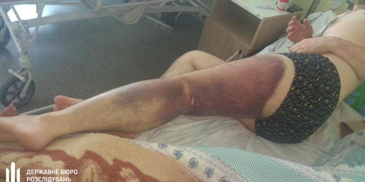 В Николаеве ГБР сообщило о подозрении трем полицейским и курсанту академии в избиении оператора майнинг-фермы (ФОТО)