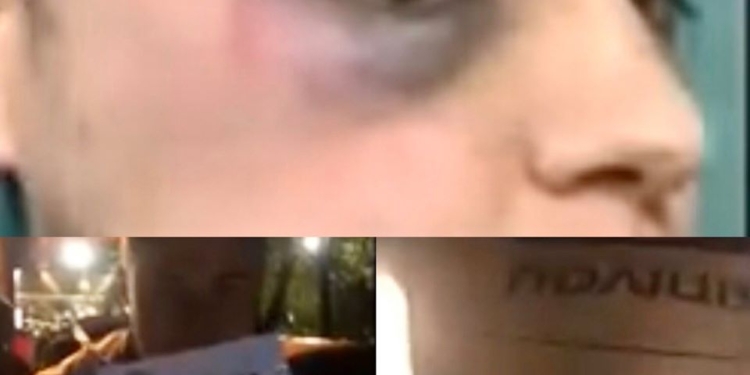 В Харькове избили журналиста после вызова полиции из-за нарушения карантина