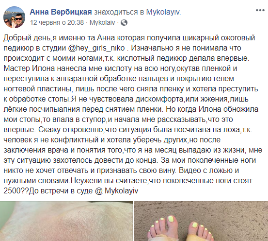 В Николаеве женщина обещает подать в суд на косметический салон из-за ожогов после педикюра (ФОТО) 1