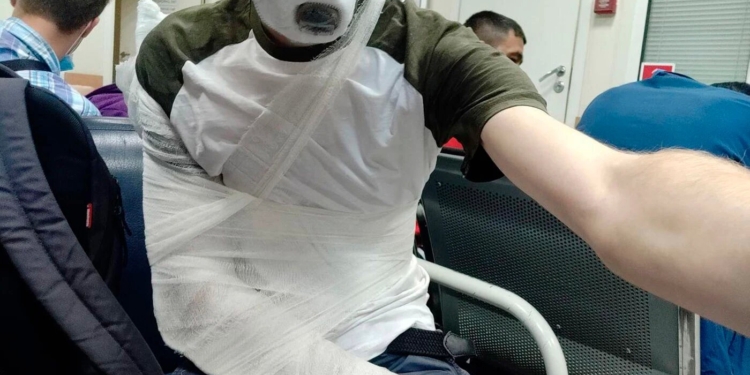 В России полицейский сломал руку журналисту, который освещал голосование по поправкам в Конституцию