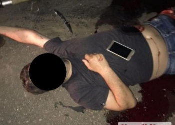 Под Николаевом на дороге нашли мужчину с огнестрельным ранением ноги (ФОТО)