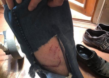 Еще один: в Николаеве бродячая собака порвала ногу режиссеру театра (ФОТО)