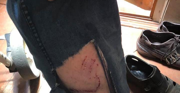 Еще один: в Николаеве бродячая собака порвала ногу режиссеру театра (ФОТО)