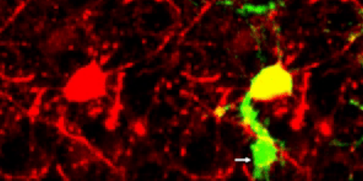Впервые снято видео того, как мозг очищает себя от мертвых нервных клеток