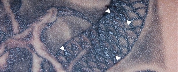 Японец сделал татуировку и потерял слух