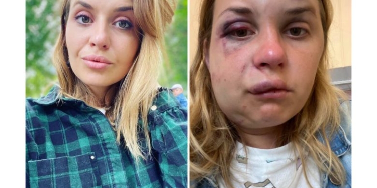 Мужчина избил и пытался изнасиловать пассажирку поезда «Мариуполь – Киев» (ФОТО, ВИДЕО)