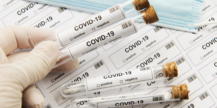 Всего 30 минут и $5: в ВОЗ заявили о создании нового экспресс-теста на коронавирус