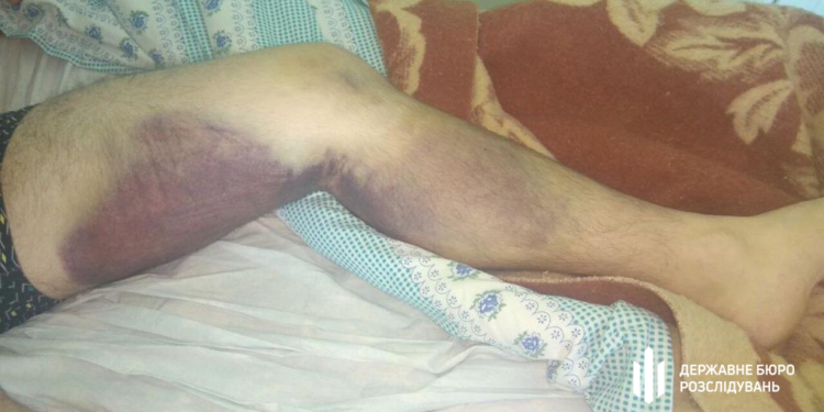 ГБР подозревает шестерых полицейских из Николаева в пытках в служебных кабинетах (ФОТО, ВИДЕО)