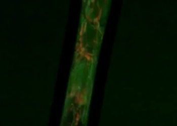 Кто чихнул? В США создали волокна, которые меняют цвет при контакте с бактериями