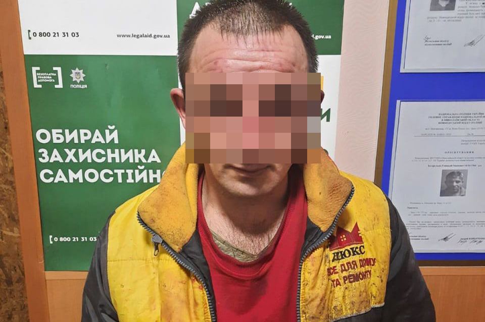 На Николаевщине мужчина пытался убить свою семью, облив жену и детей неустановленным химическим веществом (ФОТО) 11