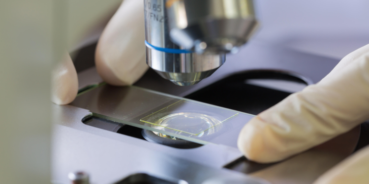 Дрожжи бывают разные, не только пекарские. Современный завод по их производству построят за счет ЕБРР