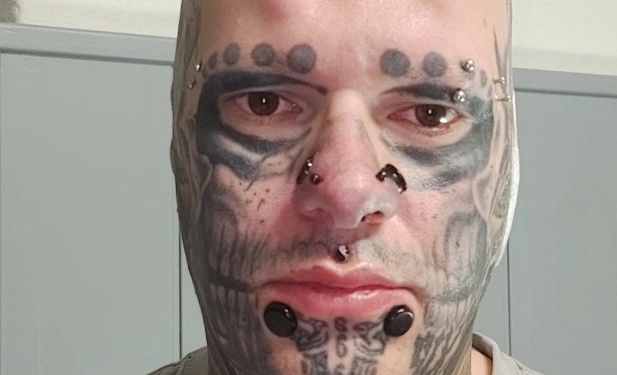 Рептилоиды среди нас. Немец сделал 17 операций, уши теперь хранит в баночке (ФОТО)