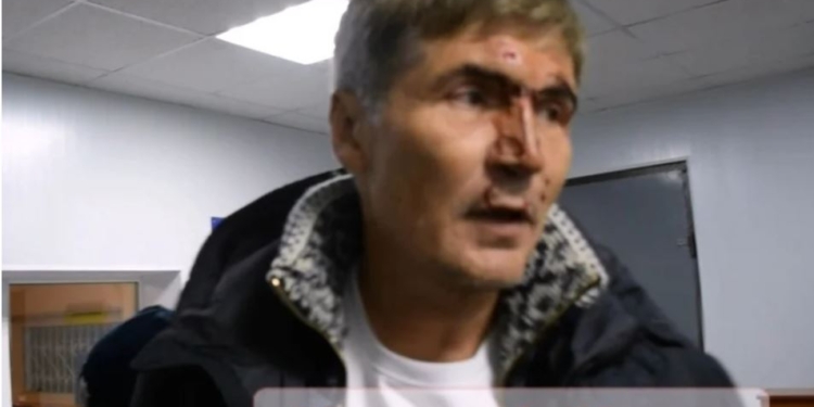 В Николаеве патрульные задержали экс-нардепа Жолобецкого. У него разбито лицо (ВИДЕО)