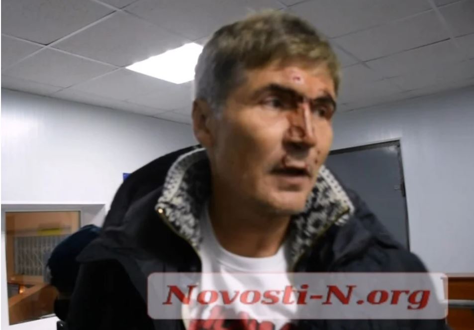 В Николаеве патрульные задержали экс-нардепа Жолобецкого. У него разбито лицо (ВИДЕО) 1
