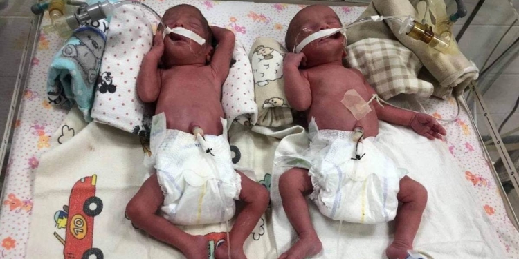 20-летняя украинка родила четверню. Врачи назвали роды уникальными (ФОТО, ВИДЕО)