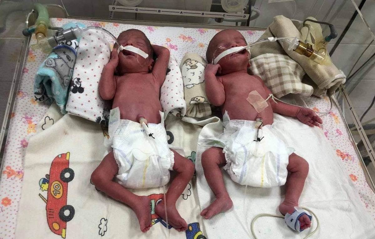 20-летняя украинка родила четверню. Врачи назвали роды уникальными (ФОТО, ВИДЕО)