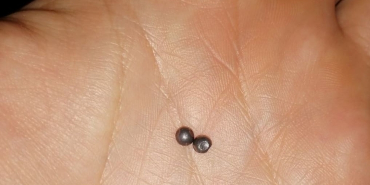 В Тернополе обстреляли ребенка, катавшегося на санках, – у него 42 ранения (ФОТО)