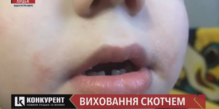 В Луцке воспитательница детсада раздавала подзатыльники и заклеивала детям рот скотчем (ВИДЕО)