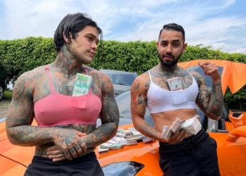 Два колумбийца ради шутки увеличили себе грудь