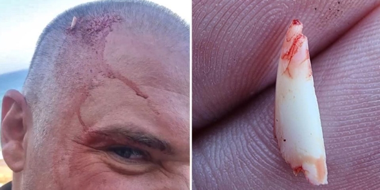 Акула сломала зуб об голову мужчины, пытаясь укусить его