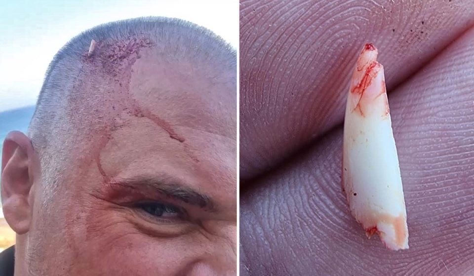 Акула сломала зуб об голову мужчины, пытаясь укусить его 1