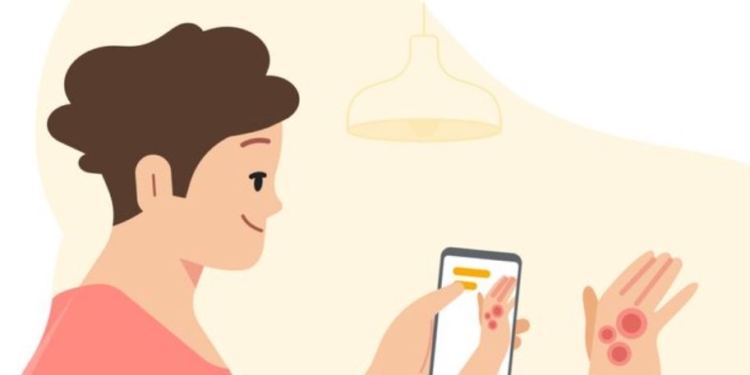 Специальное приложение Google поможет распознать заболевания кожи