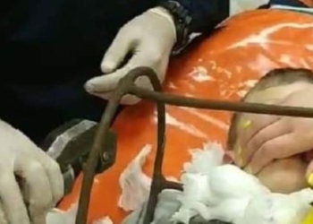 В Полтаве 6-летнему мальчику металлический штырь пробил шею насквозь. Врачи спасли жизнь ребенка