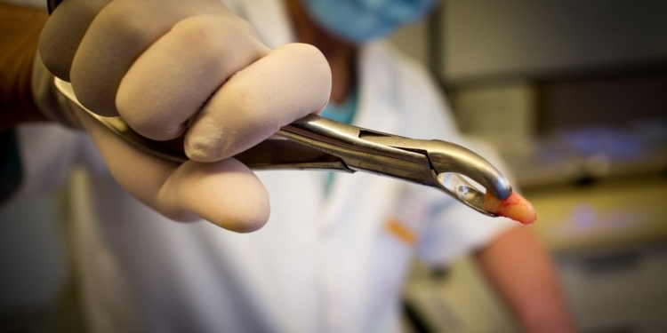 В Киевской области стоматологи удалили ребенку 12 молочных зубов вместо 3. И считают, что правы (ВИДЕО)