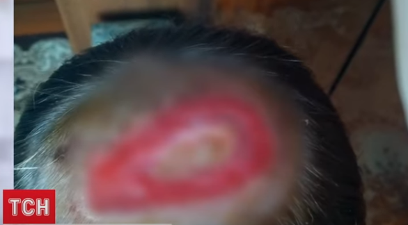 Поход к парикмахеру обернулся для жительницы Ровенщины потерей волос (ВИДЕО)