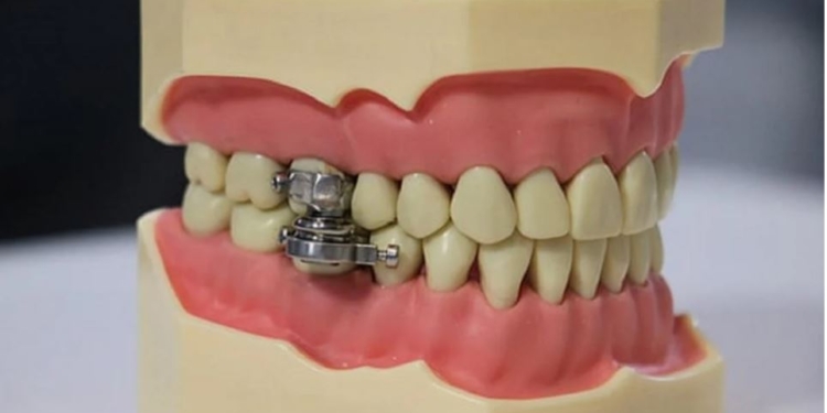 Ученые создали первое в мире устройство для похудения. Его уже назвали орудием для пыток (ФОТО)