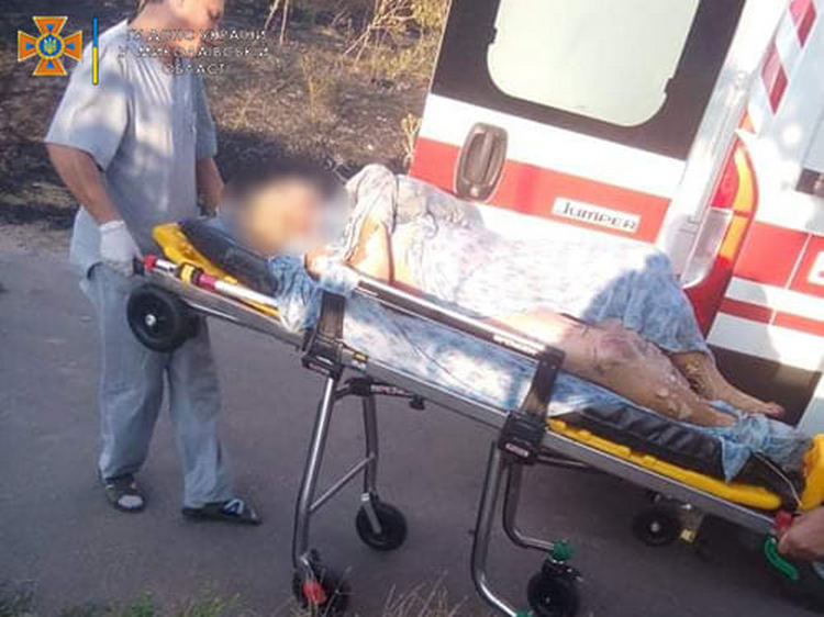 Сжигала мусор, вспыхнул сухостой, - на Николаевщине доставили в больницу женщину с тяжелыми ожогами 1