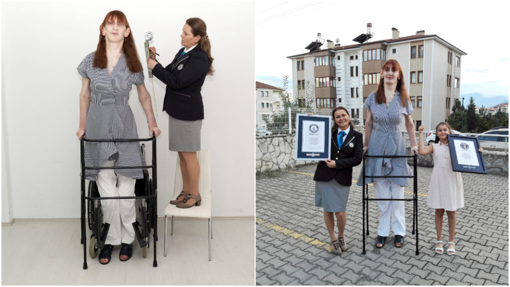 Самой высокой в мире женщиной стала турчанка. Ее рост - 215 см (ФОТО, ВИДЕО) 5