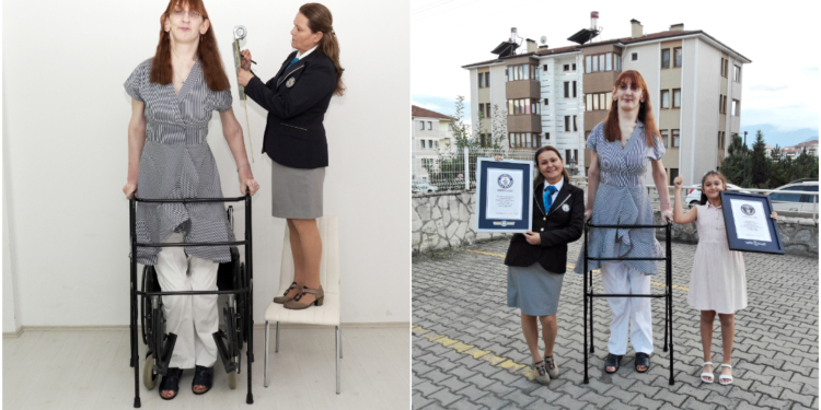 Самой высокой в мире женщиной стала турчанка. Ее рост – 215 см (ФОТО, ВИДЕО)