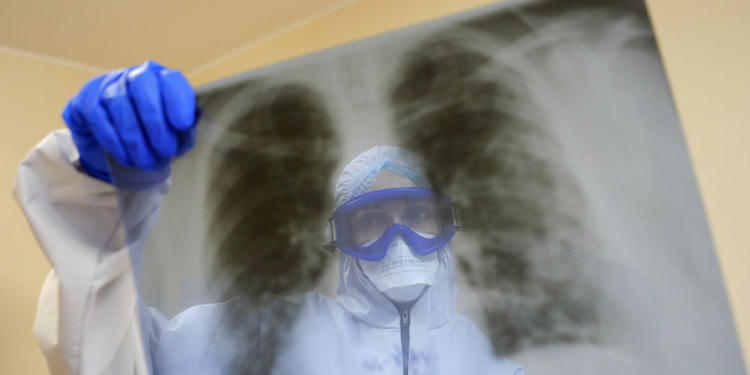 Умирающей бабушке мы концентратор не дадим, очередь из тех, у кого больше шансов – рассказ волонтера о COVID в Одессе