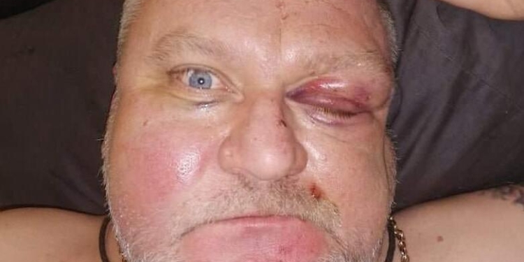 В Херсоне избили депутата горсовета за замечание о петардах