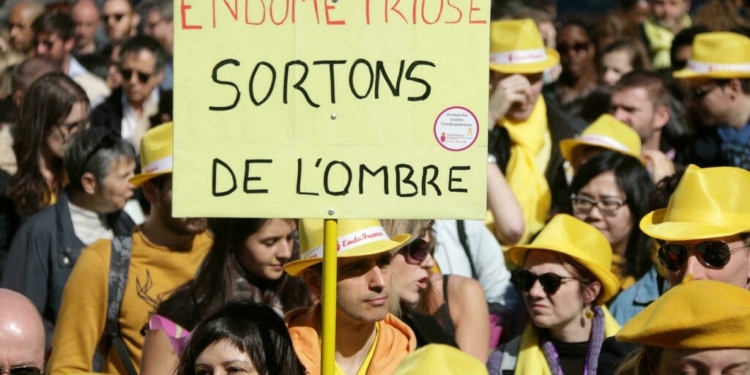 Президент Франции Эмманюэль Макрон объявил о запуске национальной стратегии по борьбе с эндометриозом