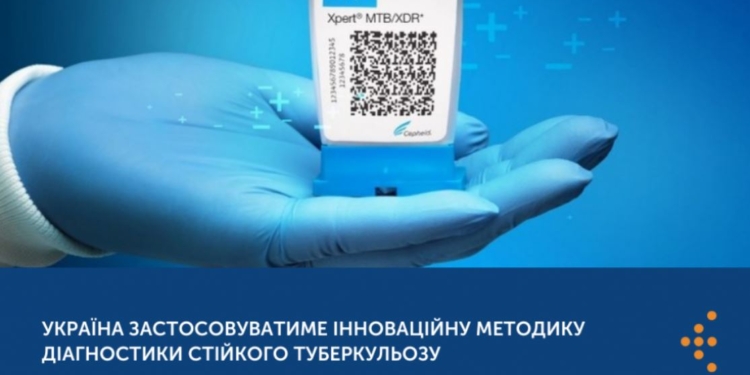 В 500 раз быстрее. В Украине для выявления устойчивых форм туберкулеза будут применять новую методику (ФОТО)